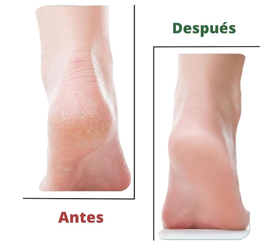 Lima Exfoliante Profesional SoftFeet™ - Pies Suaves y Sin Callos